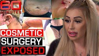 Exposing the dark underbelly of the cosmetic surgery industry | 60 Minutes Australia