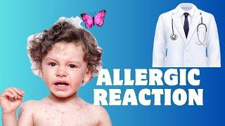 How to Understand & Manage Allergic Reaction at Home #baby #allergicreaction