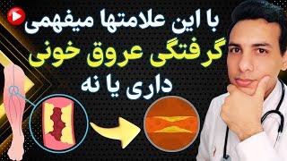 گرفتگی عروق چه علائمی داره؟ | What are the symptoms of blood clots?