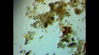 Swamp Water 100X Microscope Lancaster SC, 2 19 2023