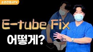 Endotracheal tube fix방법(테이프고정 & anchor fast)