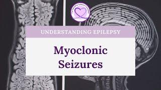 What are Myoclonic Seizures?