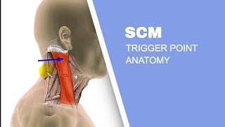 Sternocleidomastoid Muscle (SCM) Trigger Points