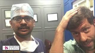 FUE Frontal Hair Transplant 2200 Grafts @ Harleys Hair transplant Clinic In Mumbai