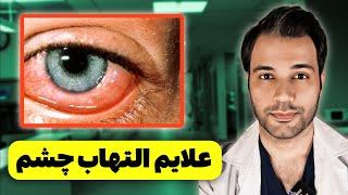 علایم وحشتناک التهاب چشم که حتما باید بدونید| عفونت با چشم چکار میکنه