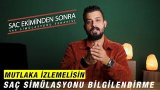 SAÇ EKİMİ SONRASI TAMAMLAYICI TEDAVİ - SAÇ SİMÜLASYONU - Uzm.Est.Semih DENİZ