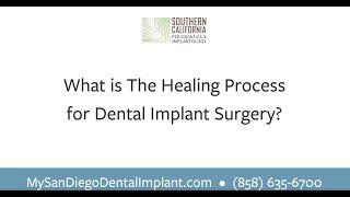 What is the healing process for dental implant surgery?| Southern California Periodontics| San Diego