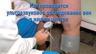 Ультразвуковое дуплексное сканирование вен