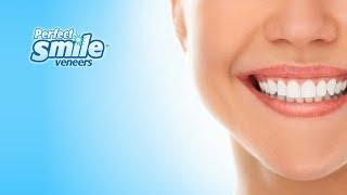 Perfect Smile Veneers Commercial As Seen On TV