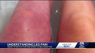 Understanding long-term leg and nerve pain