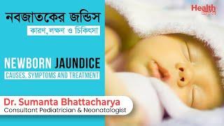 নবজাতকের জন্ডিস-কারণ, লক্ষণ ও চিকিৎসা | Newborn Jaundice -Symptoms, Causes & Treatment