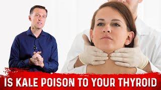 Is Kale A Poison To Your Thyroid Problems Or An Anti-Poison? – Dr. Berg