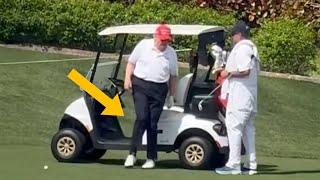 Trump HEALTH FEARS, what's wrong with his legs?