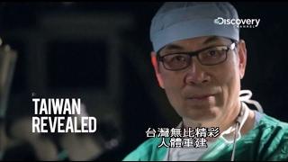 Fu Chan Wei Discovery Documentary - Vascularized Fibula (Jaw Reconstruction) 下顎重建-台灣整形外科權威-魏福全教授