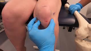 Knee bones