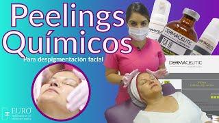 Peelings Químicos para Despigmentación facial | Euro Importaciones de Medicina Estética