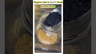 Regrow Hair Faster in Just 1 Week  #kirantutorialz #shorts #longhair #haircare