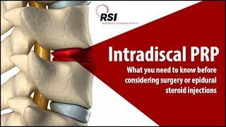 Intradiscal PRP for Spine Conditions - Regenerative Sportscare Institute Dr. Gregory Lutz