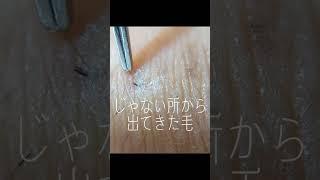 【毛抜き】じゃない所から出てきた毛#shorts #毛抜き #tweezers#ingrown hair