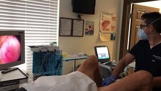 Rezūm Procedure with South Florida leading Urologist, Dr. Mike Zahalsky