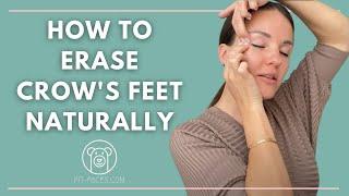 How to get rid of Crow's feet Naturally