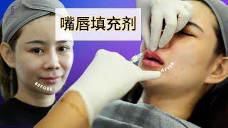 【实拍】嘴唇填充剂视频分享！- 唇部整形服务 Lip FIllers | RJ CLINIC