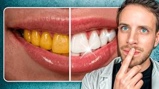 ADIEU LE DENTISTE ? Ces 5 aliments blanchissent tes dents !