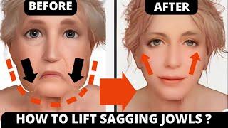 AGE 35+ | FACE LIFTING EXERCISES FOR JOWLS and SAGGY SKIN !| LAUGH LINES, GET RID OF WRINKLES