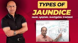 Types Of Jaundice | Causes, Symptoms & Treatment | Dr Najeeb