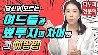 (*Eng) 피부트러블 - 여드름뾰루지 구별법과 예방  - 피부과전문의 [닥터필러]