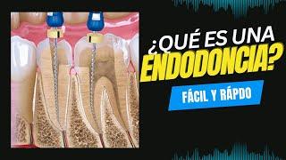 ¿Qué es una endodoncia dental? Fácil y rápido