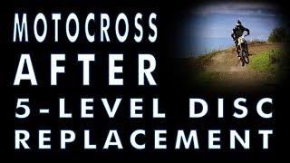 Riding Motocross after Disc Replacement Surgery at 5 Levels by ENANDE and Dr.. Ritter-Lang