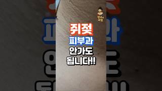 쥐젖? 방치하면 10배로 늘어납니다!! #중년건강  #건강한중년 #지식 #건강한중년 #건강정보 #건강관리 #건강상식 #건강 #장수의비밀 #50대건강 #60대건강 #쥐젖