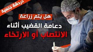 معرفة طول القضيب الحقيقي أثناء زراعة الدعامات