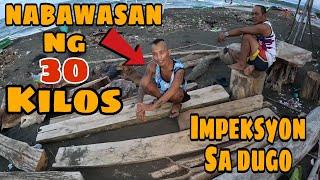 GRABE ANG NANGYARING PAGBAGSAK NG KATAWAN NIYA | SAKIT SA DUGO