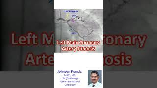Left main coronary artery stenosis