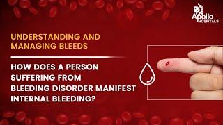 How does a person suffering from bleeding disorder manifest internal bleeding? | Dr. Gaurav Kharya