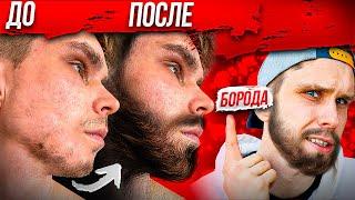 Лучший Способ Отрастить МУЖИЦКУЮ БОРОДУ! МИНОКСИДИЛ (minoxidil)