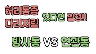 방사통 vs 연관통. “연관통은 수술 안 하셔도 됩니다.” 신경외과 전문의 남준록 원장