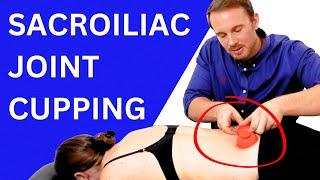 Sacroiliac (SI) Joint Cupping Techniques for Pain Relief