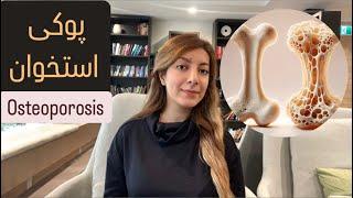 پوکی استخوان( از علائم تا درمان)/Osteoporosis