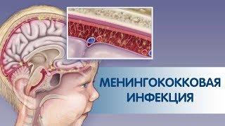 МЕНИНГОКОККОВАЯ ИНФЕКЦИЯ