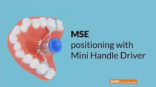 Palatal Expander MSE, Maxillary Skeletal Expander, positioning on patient with Mini Handle Driver