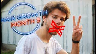 Hair Update Video - Month 5