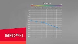 Audiograms Explained | MED-EL