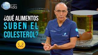  ¿Cuáles son los alimentos que suben el colesterol?