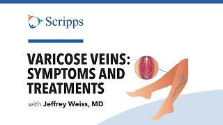 What Are Varicose Veins? with Dr. Jeffrey Weiss | San Diego Health