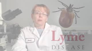 Lyme Disease Research | Dr. Rath Research Institute - Anna Goc, Ph.D.