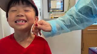 20241226 Kids dentist visit 4 Max teeth