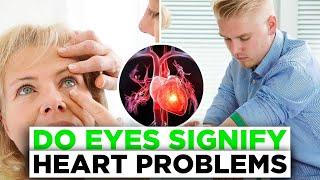 In Your Eyes: Clues to Heart Disease Risk?